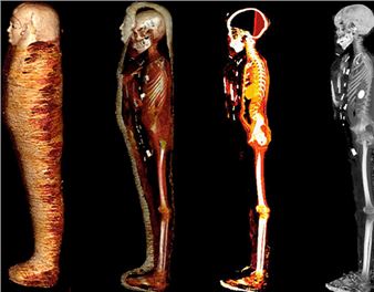 Egyptian Archaeology: Feats of Technology (Part II)