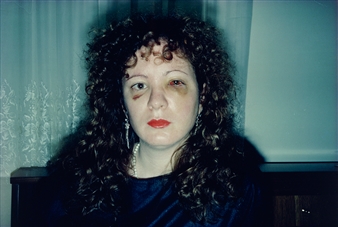 The Candor of the Camera: Nan Goldin’s Ballad of Sexual Dependency