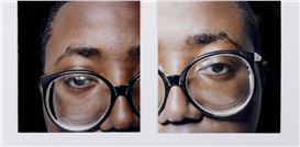 Donald Rodney: Visceral Canker – Noteworthy Retrospective of an Artist as Ambitious as He Was Audacious