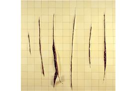 Paula Rego and Adriana Varejão: Between Your Teeth at CAM Gulbenkian